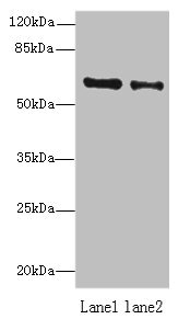 ZNF626 Antibody - Western blot All lanes: ZNF626 antibody at 10µg/ml Lane 1: HepG2 whole cell lysate Lane 2: Raji whole cell lysate Secondary Goat polyclonal to rabbit IgG at 1/10000 dilution Predicted band size: 61, 53, 11 kDa Observed band size: 61 kDa