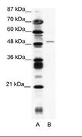 ZNF627 Antibody - A: Marker, B: Jurkat Cell Lysate.  This image was taken for the unconjugated form of this product. Other forms have not been tested.