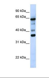 ZNF630 Antibody - 293T cell lysate. Antibody concentration: 1.0 ug/ml. Gel concentration: 12%.  This image was taken for the unconjugated form of this product. Other forms have not been tested.