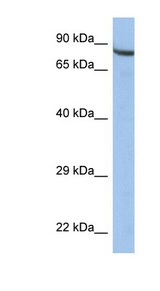 ZNF630 Antibody - ZNF630 antibody Western blot of HepG2 cell lysate. This image was taken for the unconjugated form of this product. Other forms have not been tested.