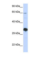 ZNF630 Antibody - ZNF630 antibody Western blot of 293T cell lysate. This image was taken for the unconjugated form of this product. Other forms have not been tested.