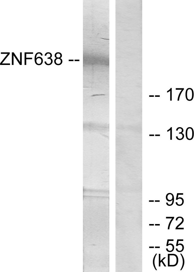 ZNF638 Antibody - Western blot analysis of lysates from HepG2 cells, treated with serum 20% 15', using ZNF638 Antibody. The lane on the right is blocked with the synthesized peptide.