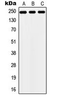 ZNF638 Antibody - Western blot analysis of ZNF638 expression in HEK293T (A); NIH3T3 (B); H9C2 (C) whole cell lysates.
