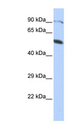 ZNF641 Antibody - ZNF641 antibody Western blot of HepG2 cell lysate. This image was taken for the unconjugated form of this product. Other forms have not been tested.