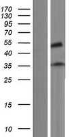 ZNF641 Protein - Western validation with an anti-DDK antibody * L: Control HEK293 lysate R: Over-expression lysate