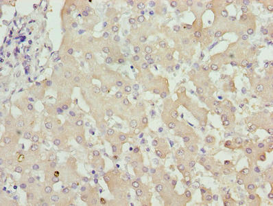 ZNF643 Antibody - Immunohistochemistry of paraffin-embedded human liver tissue using ZFP69B Antibody at dilution of 1:100