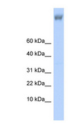 ZNF644 Antibody - ZNF644 antibody Western blot of Fetal Brain lysate. This image was taken for the unconjugated form of this product. Other forms have not been tested.