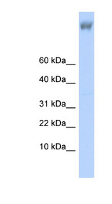 ZNF644 Antibody - ZNF644 antibody Western blot of Fetal Brain lysate. This image was taken for the unconjugated form of this product. Other forms have not been tested.