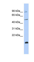 ZNF645 Antibody - ZNF645 antibody Western blot of MCF7 cell lysate. This image was taken for the unconjugated form of this product. Other forms have not been tested.