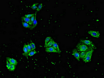 ZNF645 Antibody - Immunofluorescent analysis of HepG2 cells diluted at 1:100 and Alexa Fluor 488-congugated AffiniPure Goat Anti-Rabbit IgG(H+L)