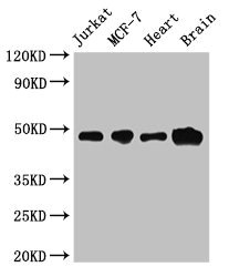 ZNF645 Antibody - Western Blot Positive WB detected in:Jurkat whole cell lysate,MCF-7 whole cell lysate,Mouse heart tissue,Mouse brain tissue All Lanes:ZNF645 antibody at 3.2µg/ml Secondary Goat polyclonal to rabbit IgG at 1/50000 dilution Predicted band size: 49 kDa Observed band size: 49 kDa