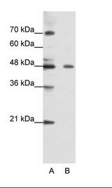 ZNF645 Antibody - A: Marker, B: Jurkat Cell Lysate.  This image was taken for the unconjugated form of this product. Other forms have not been tested.