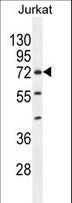 ZNF648 Antibody - ZNF648 Antibody western blot of Jurkat cell line lysates (35 ug/lane). The ZNF648 antibody detected the ZNF648 protein (arrow).