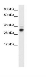 ZNF654 Antibody - Fetal Lung Lysate.  This image was taken for the unconjugated form of this product. Other forms have not been tested.