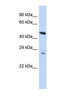 ZNF655 Antibody - Western blot of Human HepG2. ZNF655 antibody dilution 1.0 ug/ml.  This image was taken for the unconjugated form of this product. Other forms have not been tested.