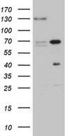 ZNF655 Antibody - HEK293T cells were transfected with the pCMV6-ENTRY control. (Left lane) or pCMV6-ENTRY ZNF655. (Right lane) cDNA for 48 hrs and lysed. Equivalent amounts of cell lysates. (5 ug per lane) were separated by SDS-PAGE and immunoblotted with anti-ZNF655. (1:2000)