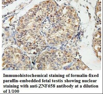 ZNF658 Antibody