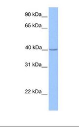 ZNF659 / ZNF385D Antibody - MCF7 cell lysate. Antibody concentration: 1.0 ug/ml. Gel concentration: 12%.  This image was taken for the unconjugated form of this product. Other forms have not been tested.