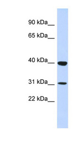 ZNF660 Antibody - ZNF660 antibody Western blot of Placenta lysate. This image was taken for the unconjugated form of this product. Other forms have not been tested.
