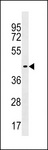 ZNF662 Antibody - ZNF662 Antibody western blot of human placenta tissue lysates (35 ug/lane). The ZNF662 antibody detected the ZNF662 protein (arrow).