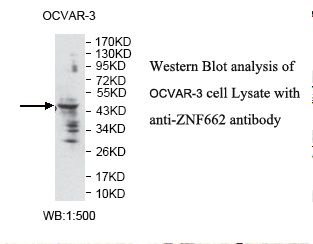 ZNF662 Antibody