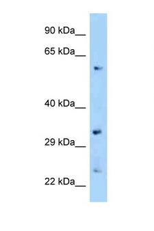 ZNF664 Antibody - ZNF664 antibody Western blot of Mouse Kidney lysate. Antibody concentration 1 ug/ml.  This image was taken for the unconjugated form of this product. Other forms have not been tested.