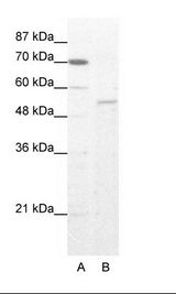 ZNF665 Antibody - A: Marker, B: HepG2 Cell Lysate.  This image was taken for the unconjugated form of this product. Other forms have not been tested.