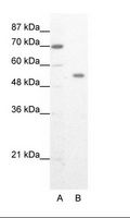 ZNF665 Antibody - A: Marker, B: HepG2 Cell Lysate.  This image was taken for the unconjugated form of this product. Other forms have not been tested.