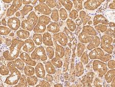ZNF665 Antibody - Immunochemical staining of human ZNF665 in human kidney with rabbit polyclonal antibody at 1:100 dilution, formalin-fixed paraffin embedded sections.
