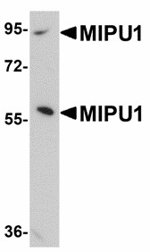 ZNF667 / MIPU1 Antibody - Western blot of MIPU1 in human brain tissue lysate with MIPU1 antibody at 1 ug/ml. Below: Immunohistochemistry of MIPU1 in human brain tissue with MIPU1 antibody at 2.5 ug/ml.