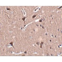 ZNF667 / MIPU1 Antibody - Immunohistochemistry of MIPU1 in human brain tissue with MIPU1 antibody at 2.5 µg/mL.