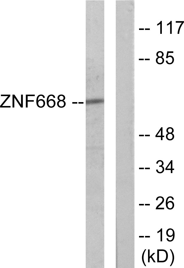 ZNF668 Antibody - Western blot analysis of lysates from Jurkat cells, using ZNF668 Antibody. The lane on the right is blocked with the synthesized peptide.