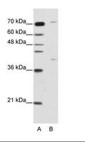 ZNF668 Antibody - A: Marker, B: HepG2 Cell Lysate.  This image was taken for the unconjugated form of this product. Other forms have not been tested.