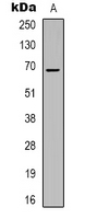 ZNF668 Antibody - Western blot analysis of ZNF668 expression in HepG2 (A) whole cell lysates.