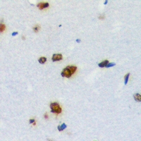 ZNF668 Antibody - Immunohistochemical analysis of ZNF668 staining in human brain formalin fixed paraffin embedded tissue section. The section was pre-treated using heat mediated antigen retrieval with sodium citrate buffer (pH 6.0). The section was then incubated with the antibody at room temperature and detected with HRP and DAB as chromogen. The section was then counterstained with hematoxylin and mounted with DPX.