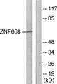 ZNF668 Antibody - Western blot analysis of extracts from Jurkat cells, using ZNF668 antibody.