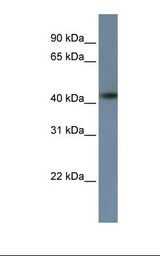 ZNF669 Antibody - HepG2 cell lysate. Antibody concentration: 1.0 ug/ml. Gel concentration: 12%.  This image was taken for the unconjugated form of this product. Other forms have not been tested.