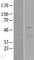 ZNF669 Protein - Western validation with an anti-DDK antibody * L: Control HEK293 lysate R: Over-expression lysate