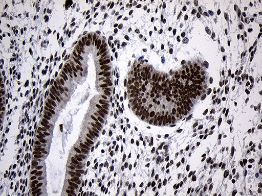 ZNF670 Antibody - Immunohistochemical staining of paraffin-embedded Human endometrium tissue within the normal limits using anti-ZNF670 mouse monoclonal antibody. (Heat-induced epitope retrieval by 1mM EDTA in 10mM Tris buffer. (pH8.5) at 120°C for 3 min. (1:500)