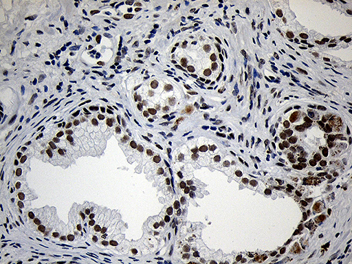 ZNF670 Antibody - Immunohistochemical staining of paraffin-embedded Human prostate tissue within the normal limits using anti-ZNF670 mouse monoclonal antibody. (Heat-induced epitope retrieval by 1mM EDTA in 10mM Tris buffer. (pH8.5) at 120°C for 3 min. (1:500)