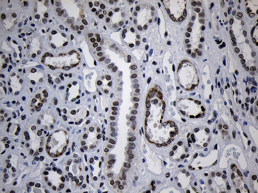 ZNF670 Antibody - Immunohistochemical staining of paraffin-embedded Human Kidney tissue within the normal limits using anti-ZNF670 mouse monoclonal antibody. (Heat-induced epitope retrieval by 1mM EDTA in 10mM Tris buffer. (pH8.5) at 120°C for 3 min. (1:500)