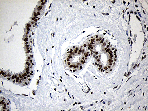 ZNF670 Antibody - Immunohistochemical staining of paraffin-embedded Human breast tissue within the normal limits using anti-ZNF670 mouse monoclonal antibody. (Heat-induced epitope retrieval by 1mM EDTA in 10mM Tris buffer. (pH8.5) at 120°C for 3 min. (1:500)