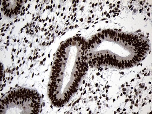 ZNF670 Antibody - Immunohistochemical staining of paraffin-embedded Human endometrium tissue within the normal limits using anti-ZNF670 mouse monoclonal antibody. (Heat-induced epitope retrieval by 1mM EDTA in 10mM Tris buffer. (pH8.5) at 120°C for 3 min. (1:500)