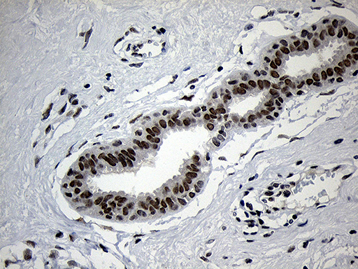 ZNF670 Antibody - Immunohistochemical staining of paraffin-embedded Human breast tissue within the normal limits using anti-ZNF670 mouse monoclonal antibody. (Heat-induced epitope retrieval by 1mM EDTA in 10mM Tris buffer. (pH8.5) at 120°C for 3 min. (1:500)