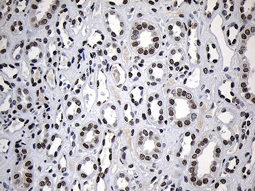 ZNF670 Antibody - Immunohistochemical staining of paraffin-embedded Human Kidney tissue within the normal limits using anti-ZNF670 mouse monoclonal antibody. (Heat-induced epitope retrieval by 1mM EDTA in 10mM Tris buffer. (pH8.5) at 120°C for 3 min. (1:500)