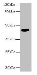ZNF670 Antibody - Western blot All lanes: ZNF670 antibody at 5µg/ml + HepG2 whole cell lysate Secondary Goat polyclonal to rabbit IgG at 1/10000 dilution Predicted band size: 45 kDa Observed band size: 45 kDa