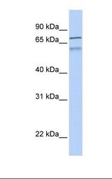 ZNF671 Antibody - Fetal brain lysate. Antibody concentration: 1.0 ug/ml. Gel concentration: 12%.  This image was taken for the unconjugated form of this product. Other forms have not been tested.