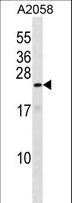 ZNF673 Antibody - ZN673 Antibody western blot of A2058 cell line lysates (35 ug/lane). The ZN673 antibody detected the ZN673 protein (arrow).