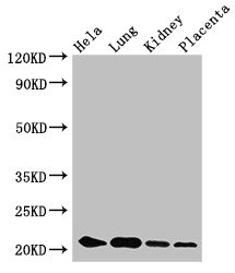 ZNF673 Antibody - Western Blot Positive WB detected in: Hela whole cell lysate, Mouse lung tissue, Mouse kidney tissue, Mouse placenta tissue All lanes: KRBOX4 antibody at 3.4µg/ml Secondary Goat polyclonal to rabbit IgG at 1/50000 dilution Predicted band size: 21, 20, 12 kDa Observed band size: 21 kDa