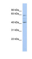 ZNF674 Antibody - ZNF674 antibody Western blot of COLO205 cell lysate. This image was taken for the unconjugated form of this product. Other forms have not been tested.